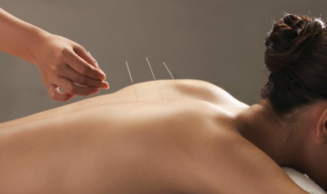 Finalmente se prueba que la acupuntura reduce el dolor